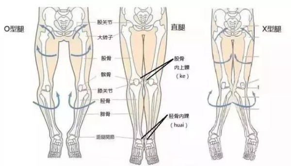 下肢力线示意图图片